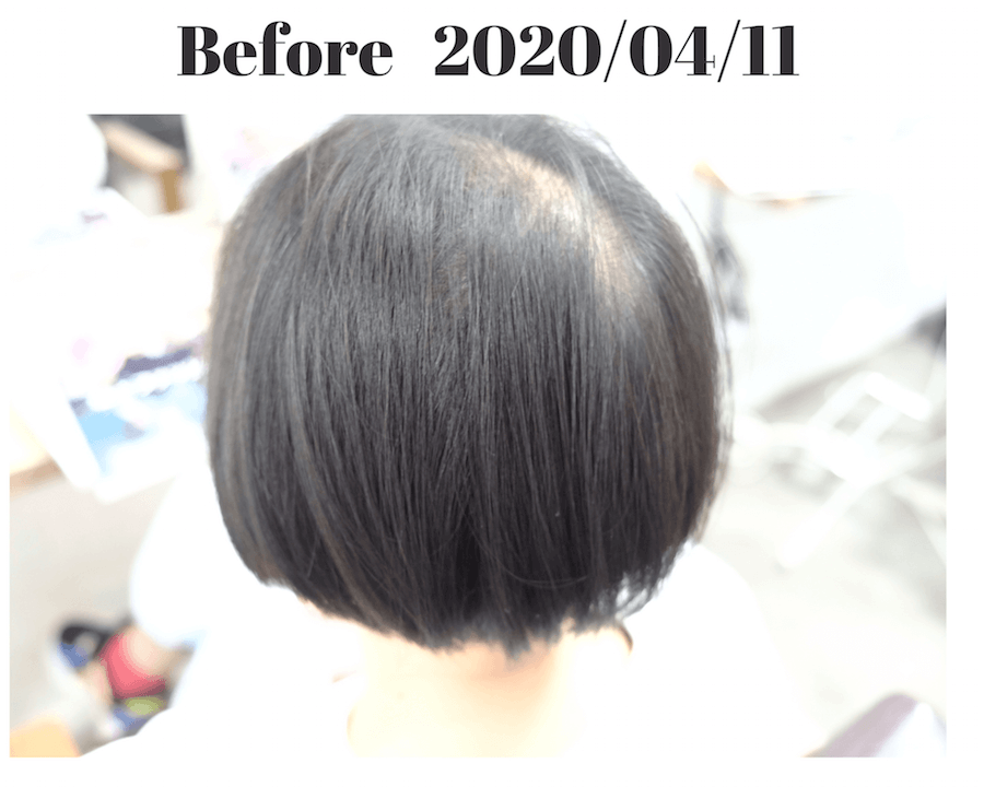 強髪プログラム】１ヶ月半で驚異の効果が 呉市の美容院 rely on chokilog