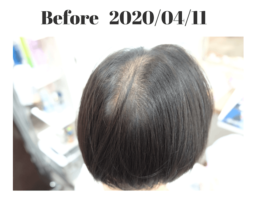 強髪プログラム】１ヶ月半で驚異の効果が 呉市の美容院 rely on - chokilog